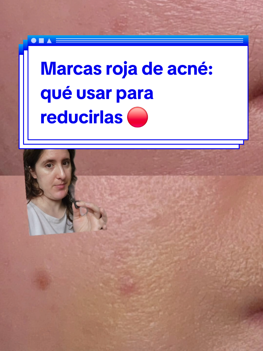 @Puli✨️Dermocosmiatra rebelde