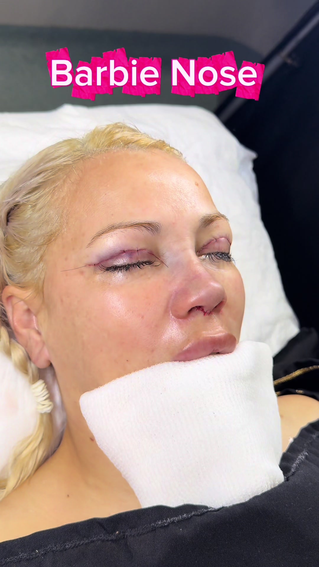 @drgarone.rinoplastia