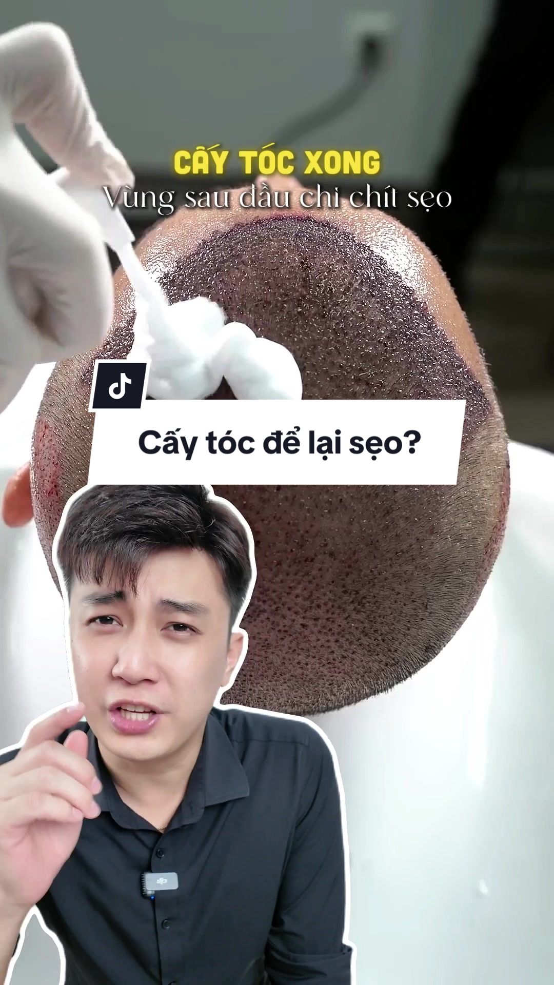 @Th&aacute;i Sơn T&oacute;c Giả