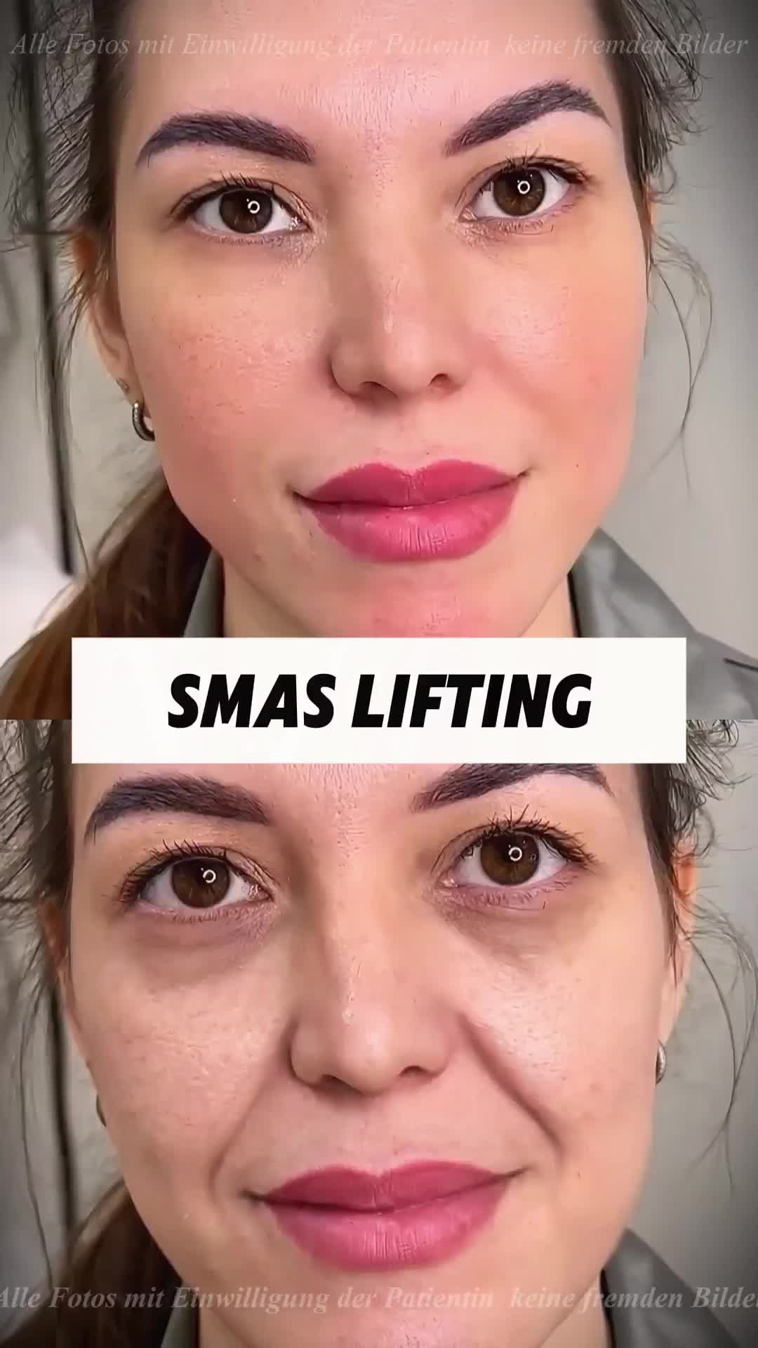 @Xue Skin & Contour