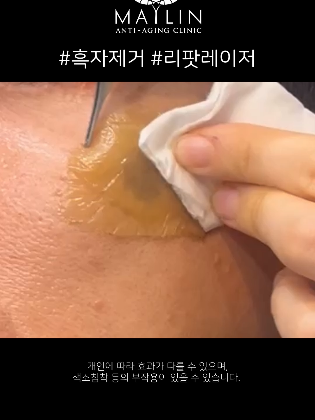 @메이린의원대구점