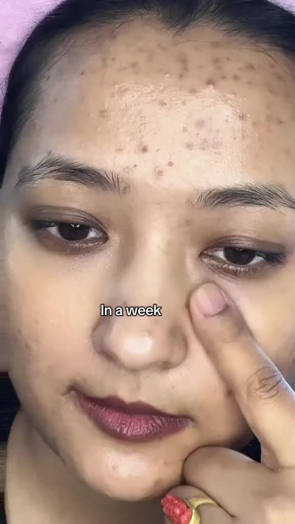 @Anuradha