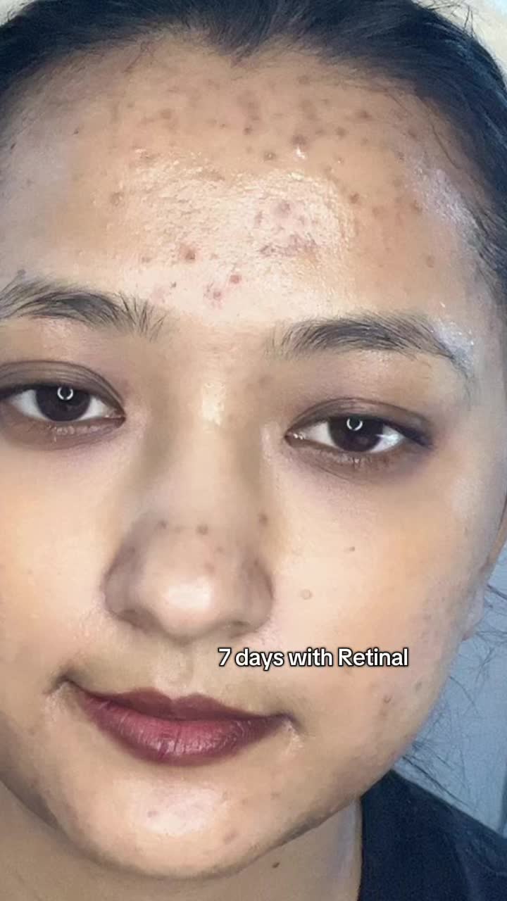 @Anuradha