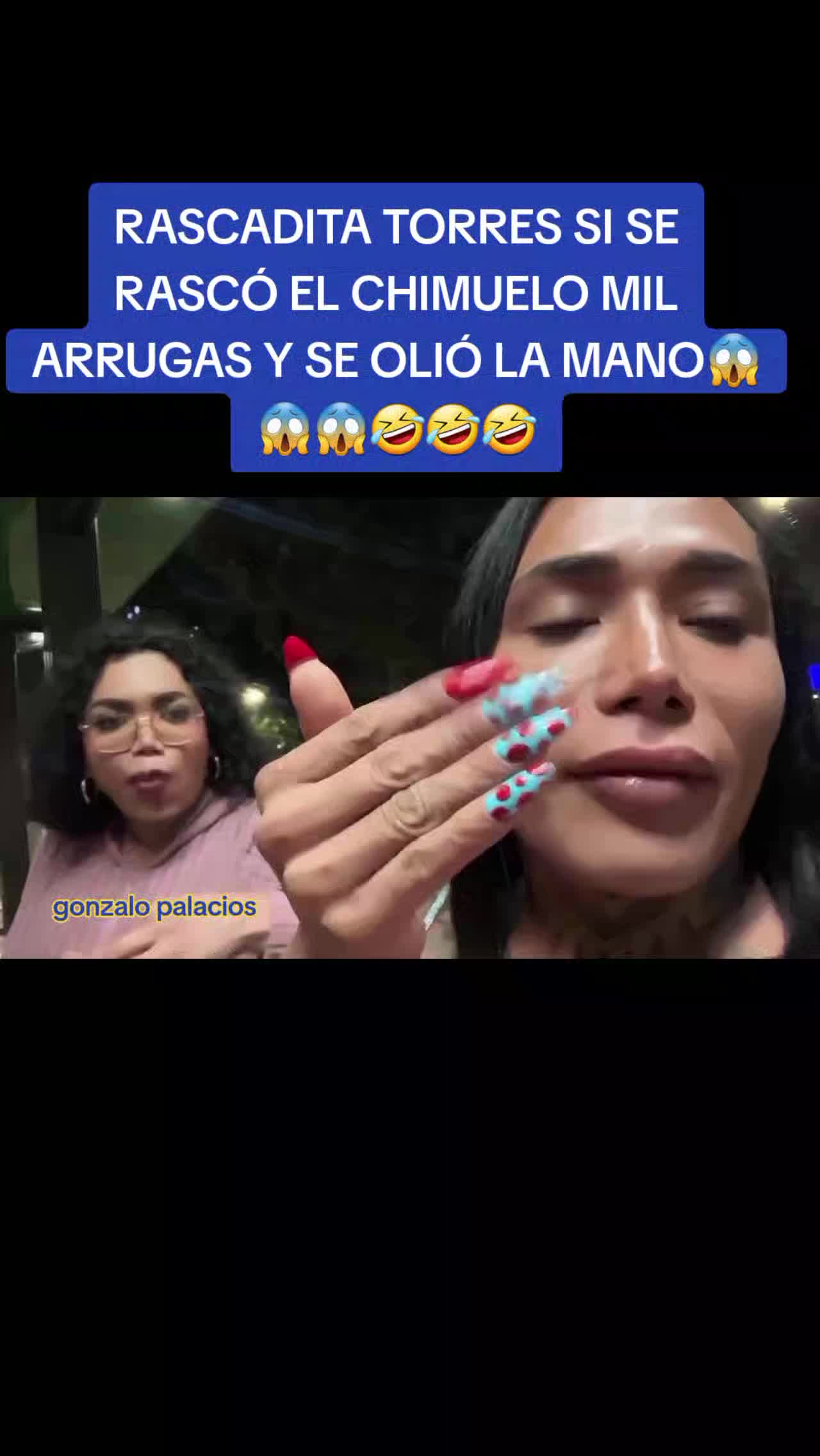 @Gonzalo