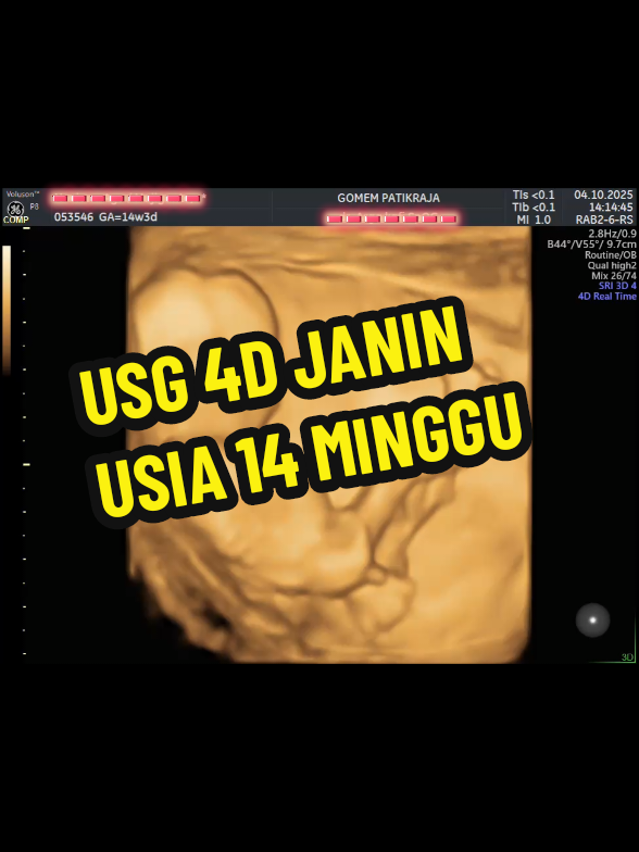 @USG 4D PURWOKERTO