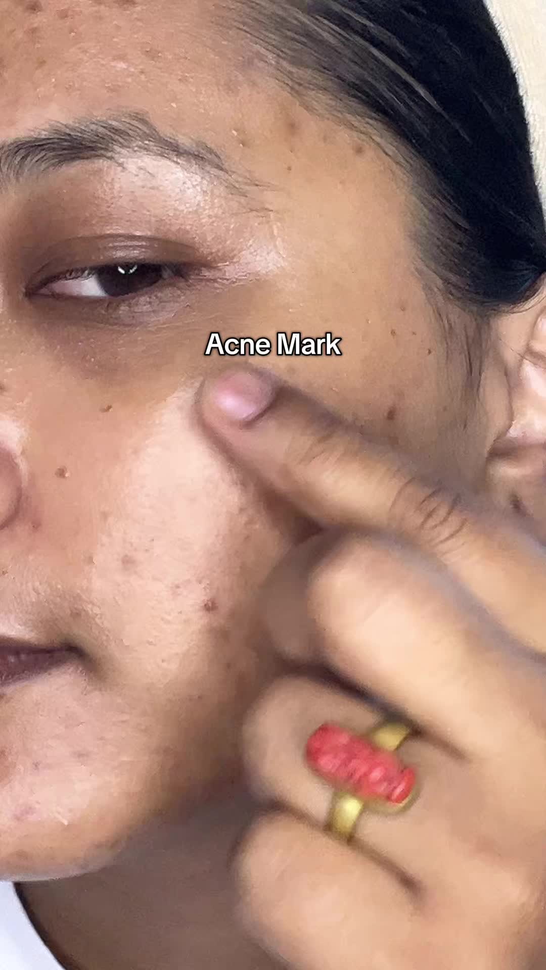 @Anuradha