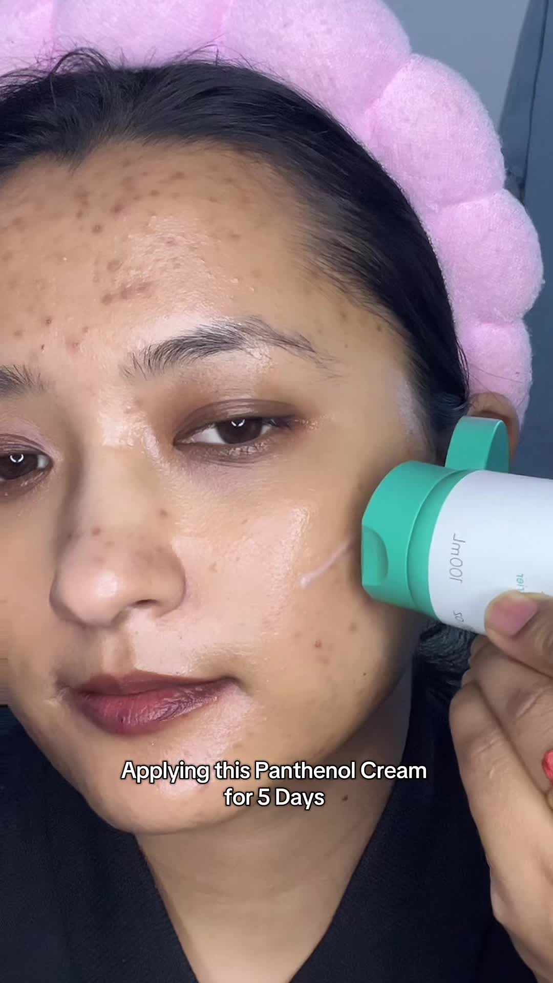 @Anuradha