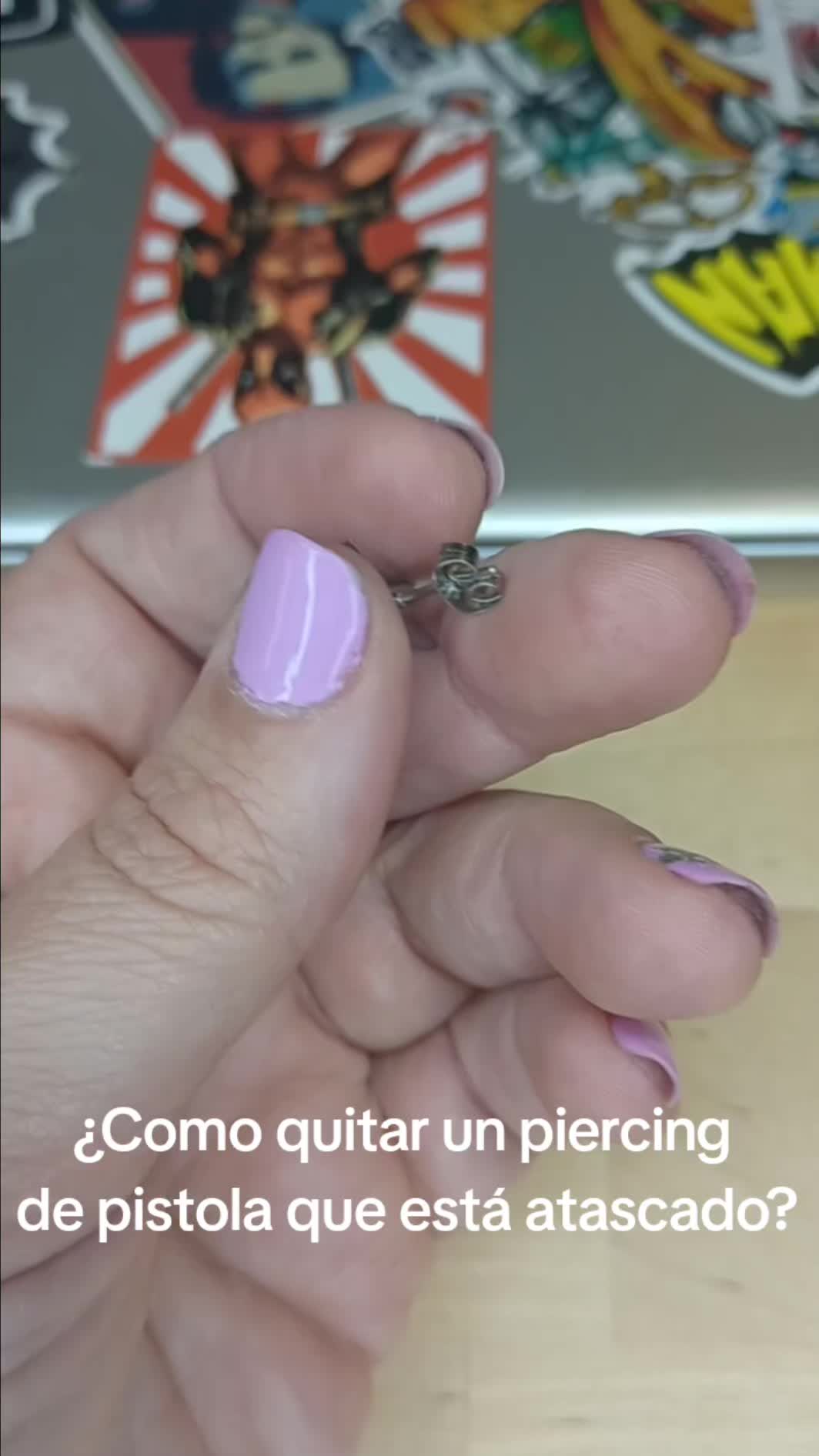 @noepinchapieles