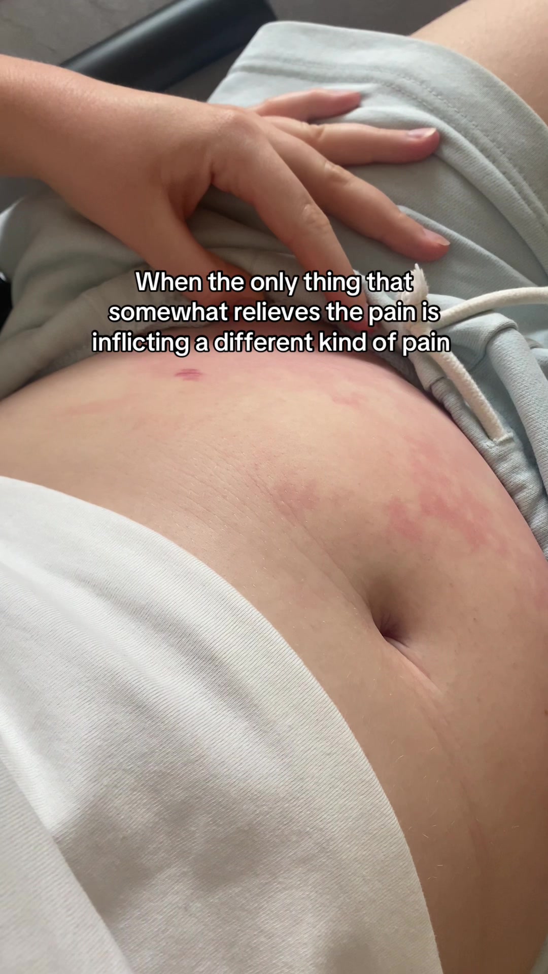 @Chloe | Endo Diary🎗️