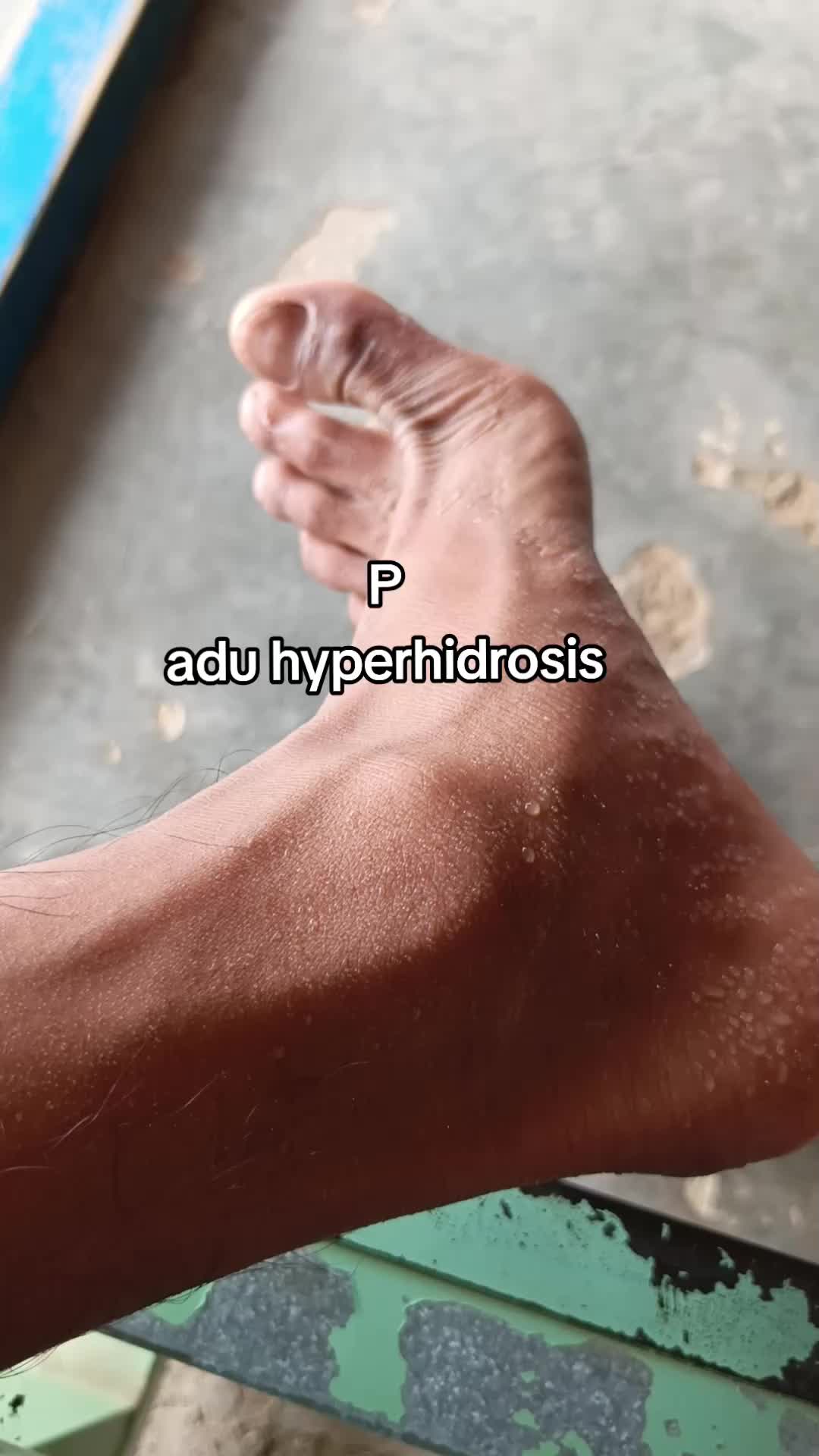 @shen_dy🧟&zwj;♂️