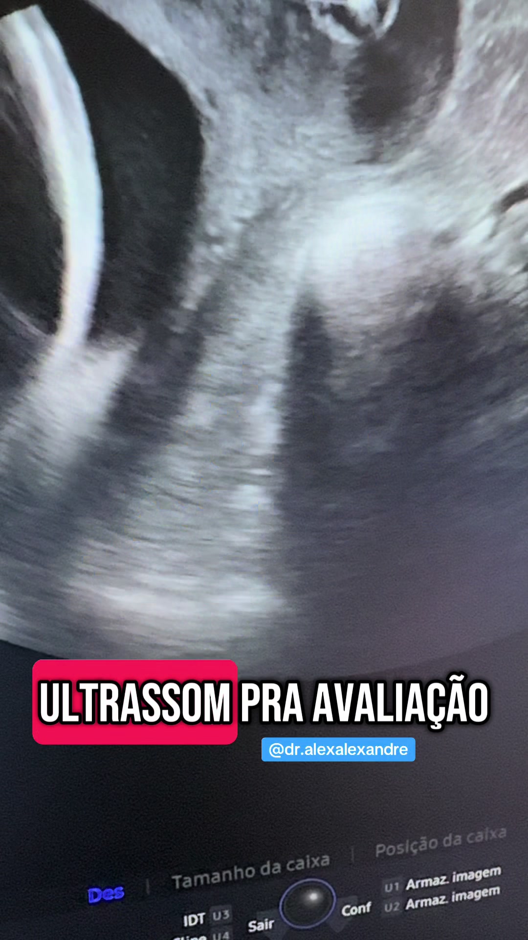@Dr Alex Alexandre