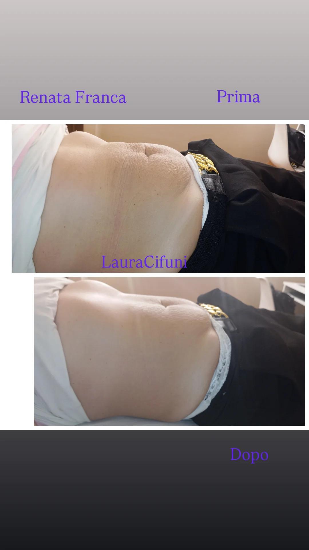 @LauraCifuni