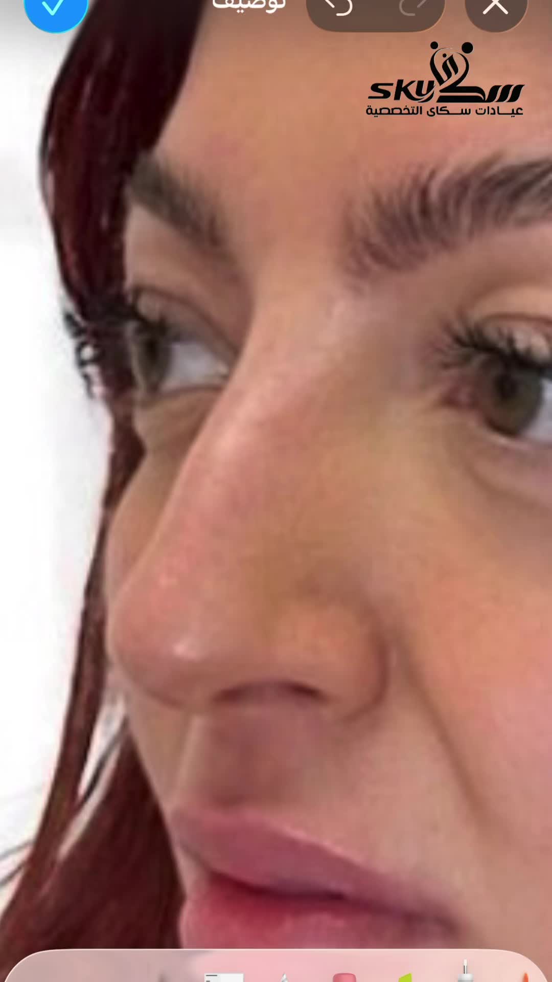 @عيادات سكاي - sky clinic