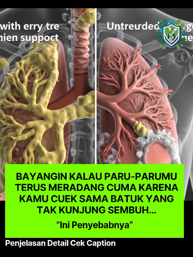 @InfoSehat.id 💚