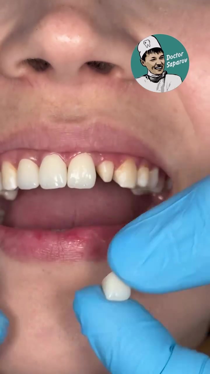 @brightsmileee1