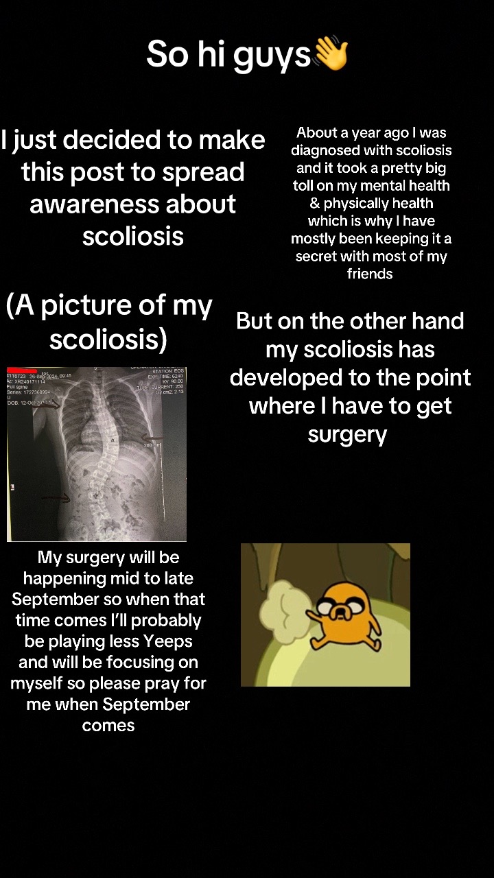 @Ⴆυƚƚҽɾ_Ⴆσι🧈