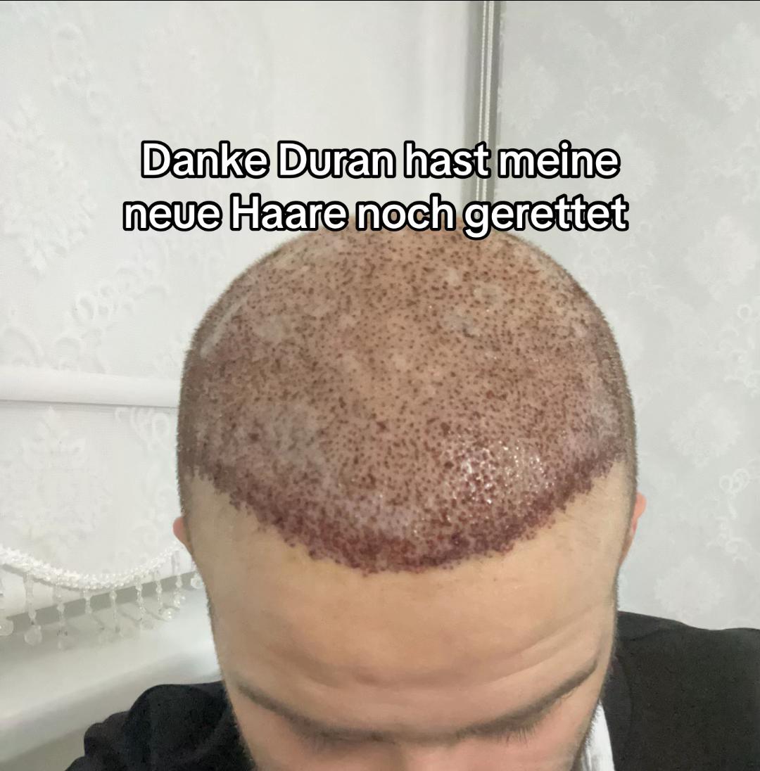 @BeratLiveHH_Twitch