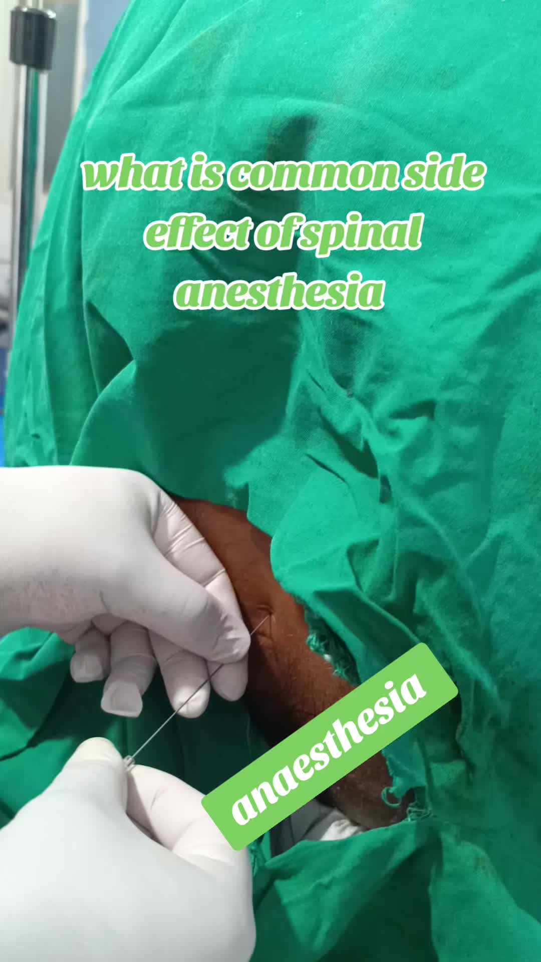 @propofol 💉