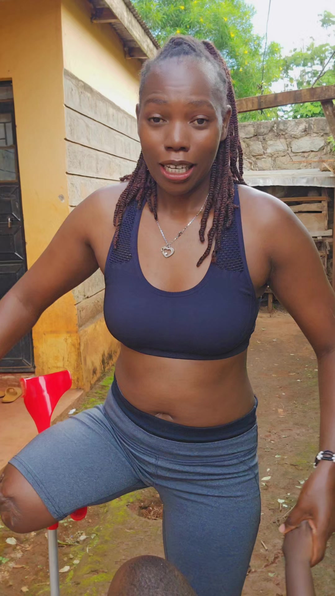 @💎Nattie Amputee🇰🇪♊️