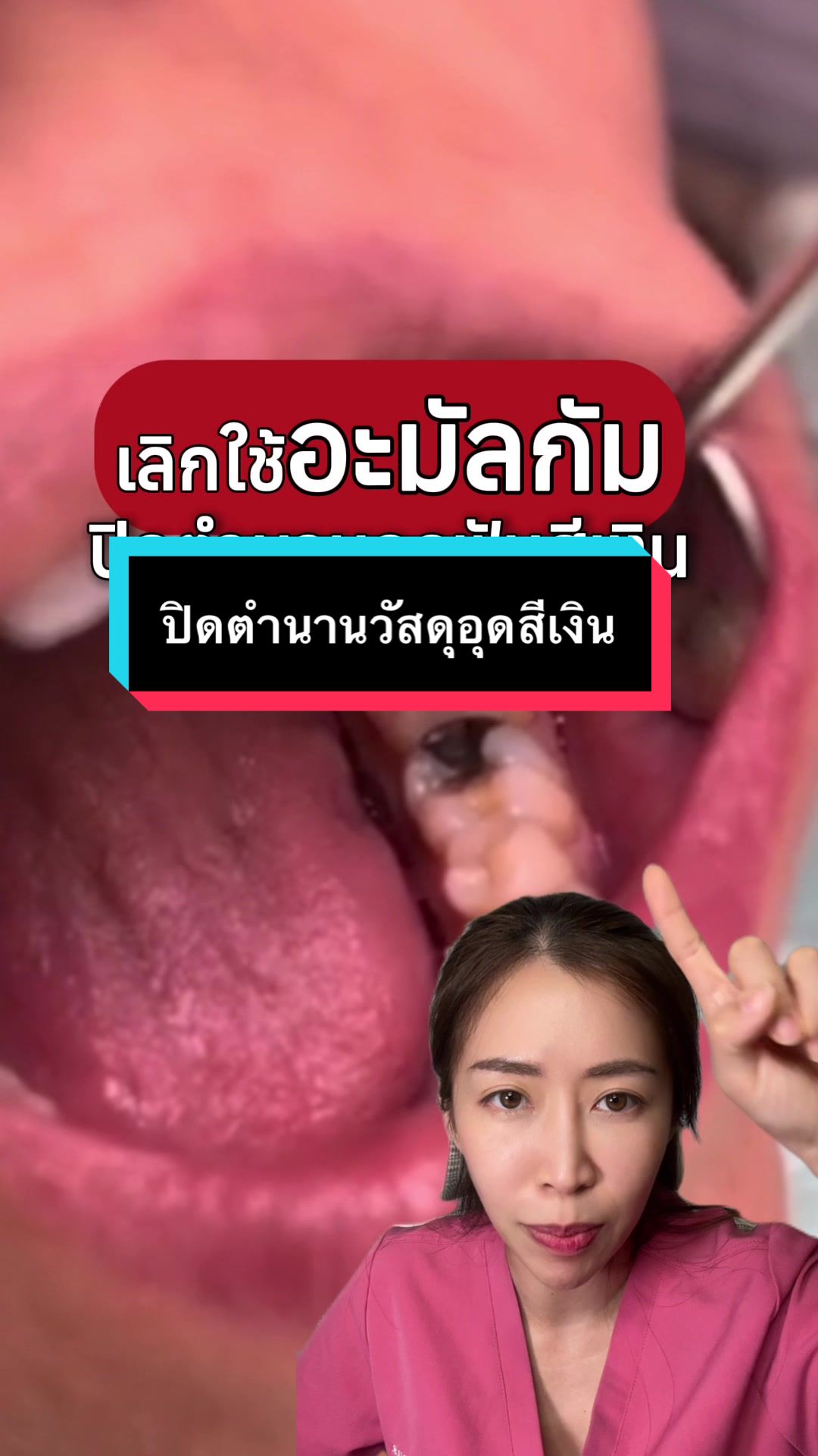 @ณัฐคุณ (Nuttakul Dent) 🦷