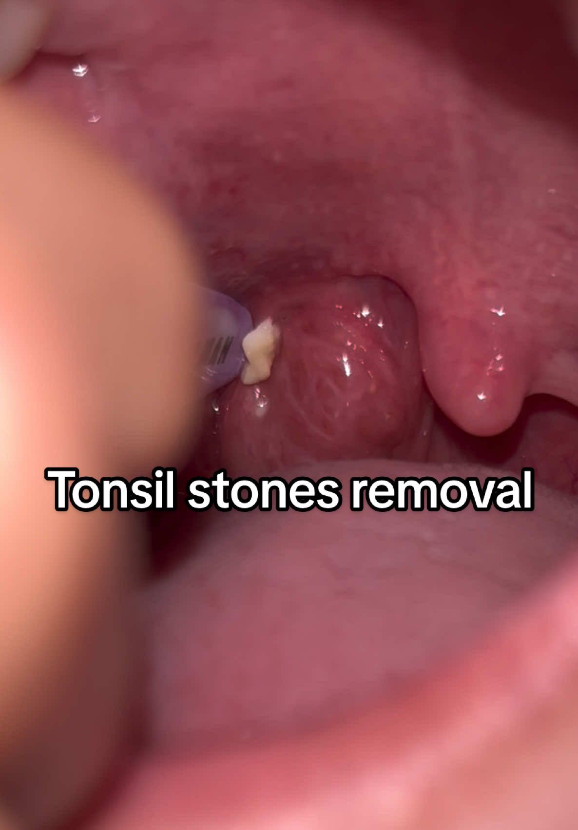 @satisyingpops