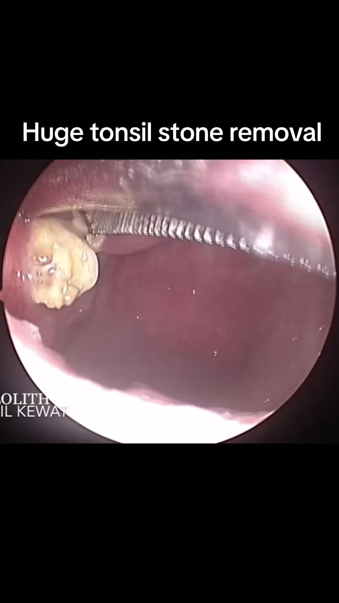 @satisyingpops