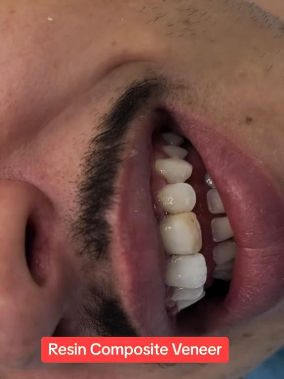@brightsmileee1
