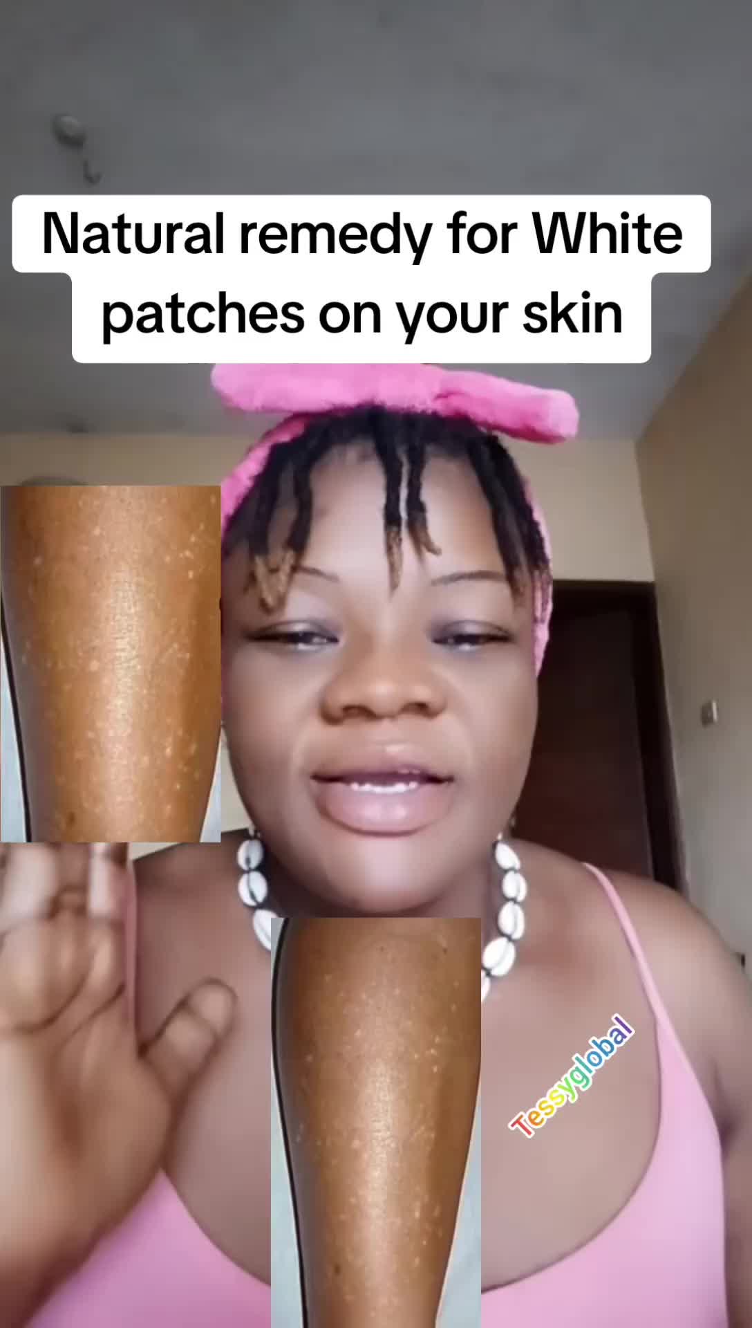 @Tessyglobal (oby)