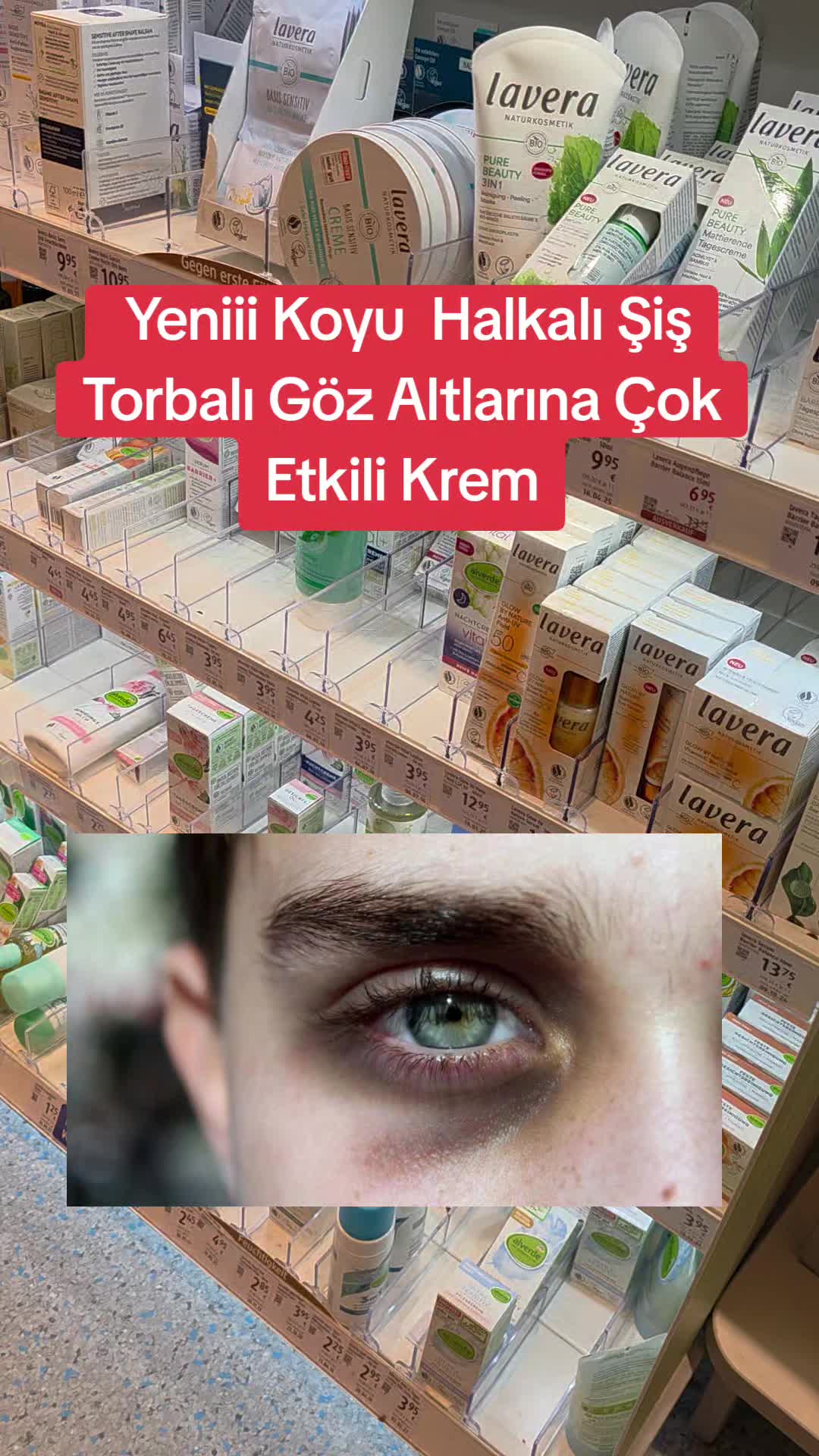 @Gurbet Ana