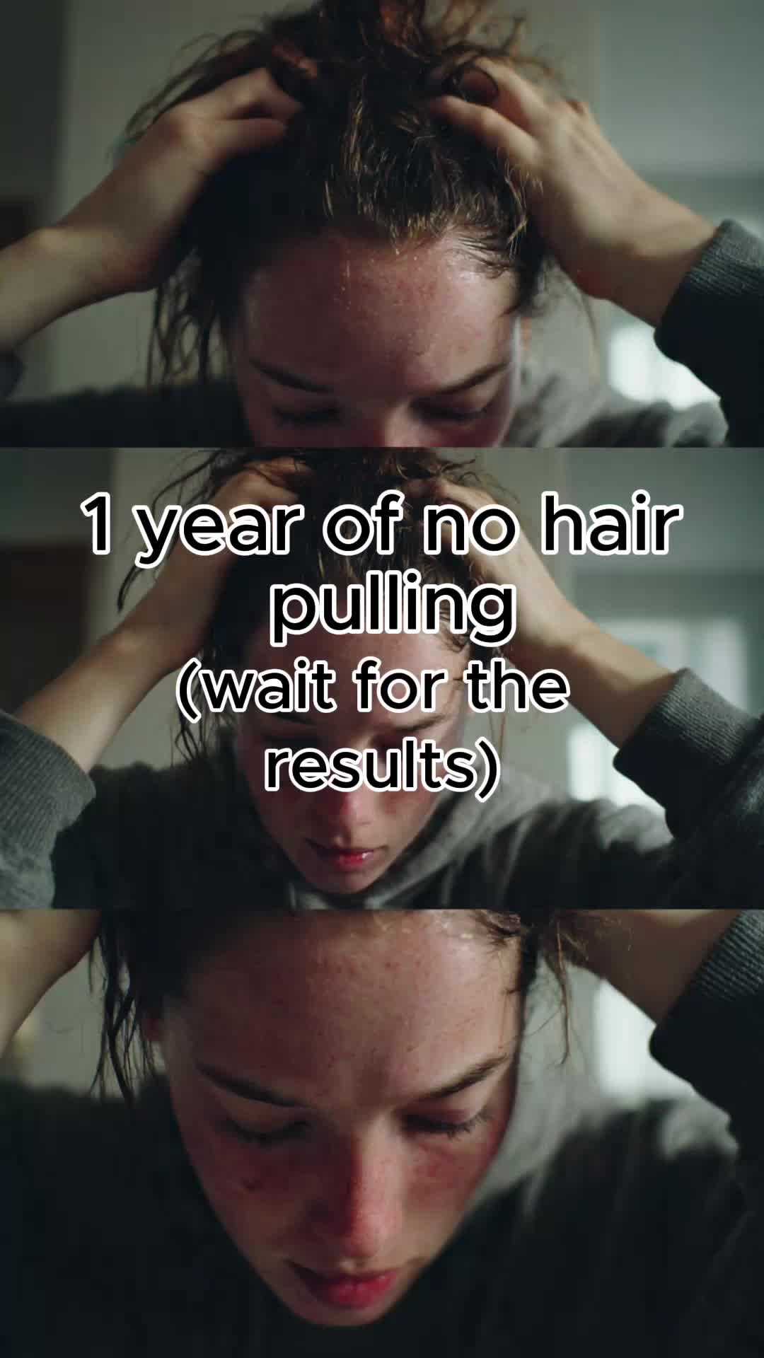 @CalmHairApp