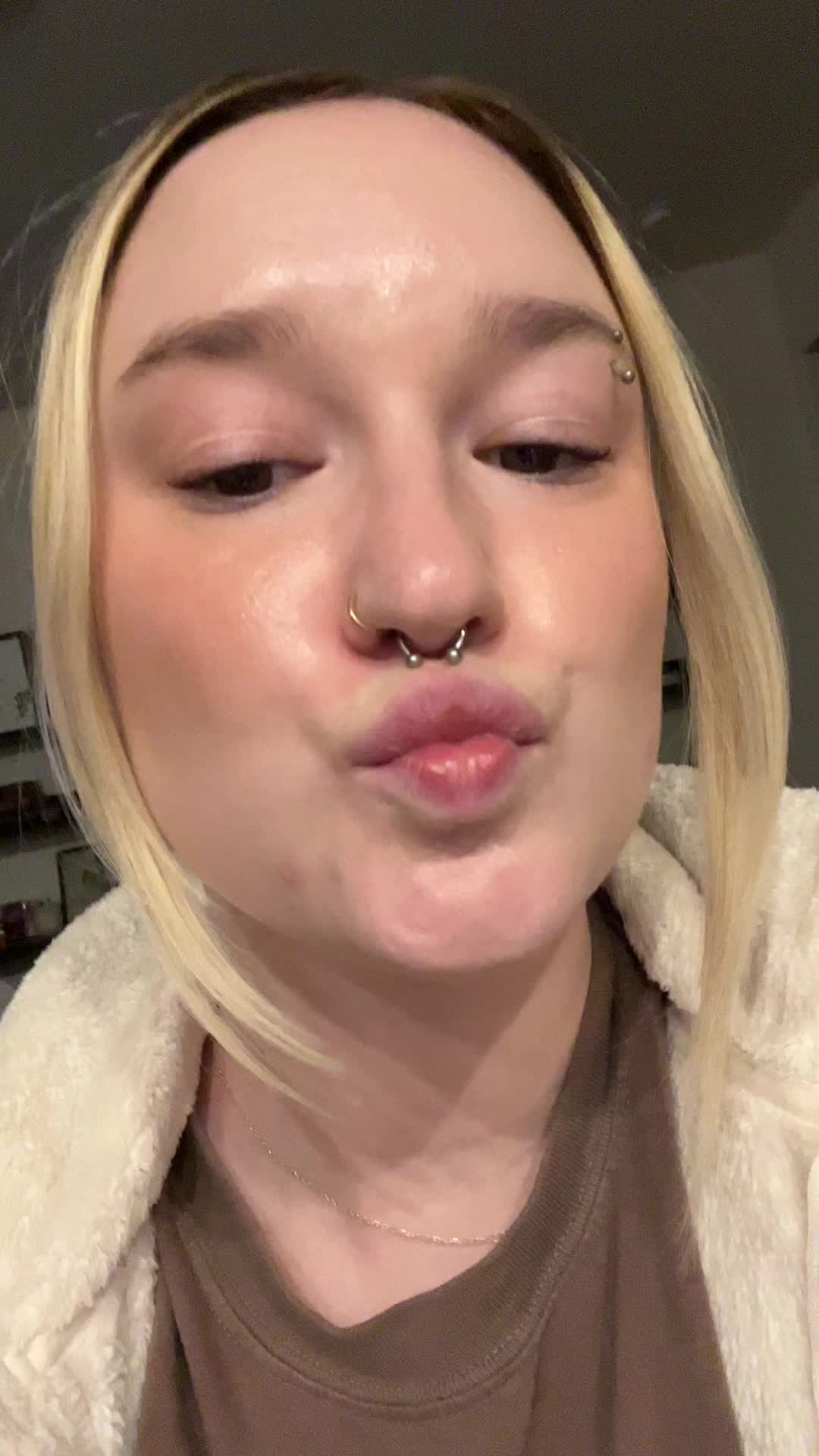@Bay | Acne Baddie ✨