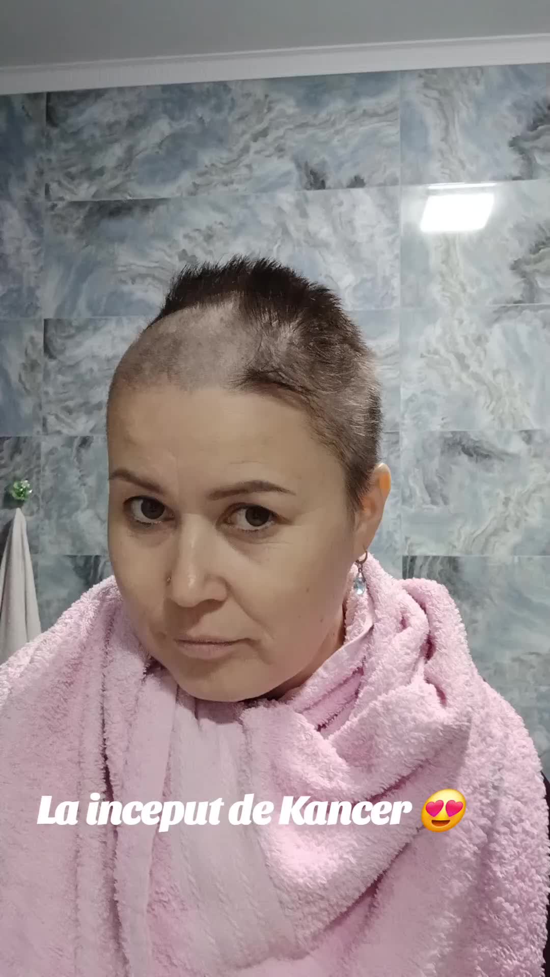 @Denutu💘luptatoare cu kancer🥹