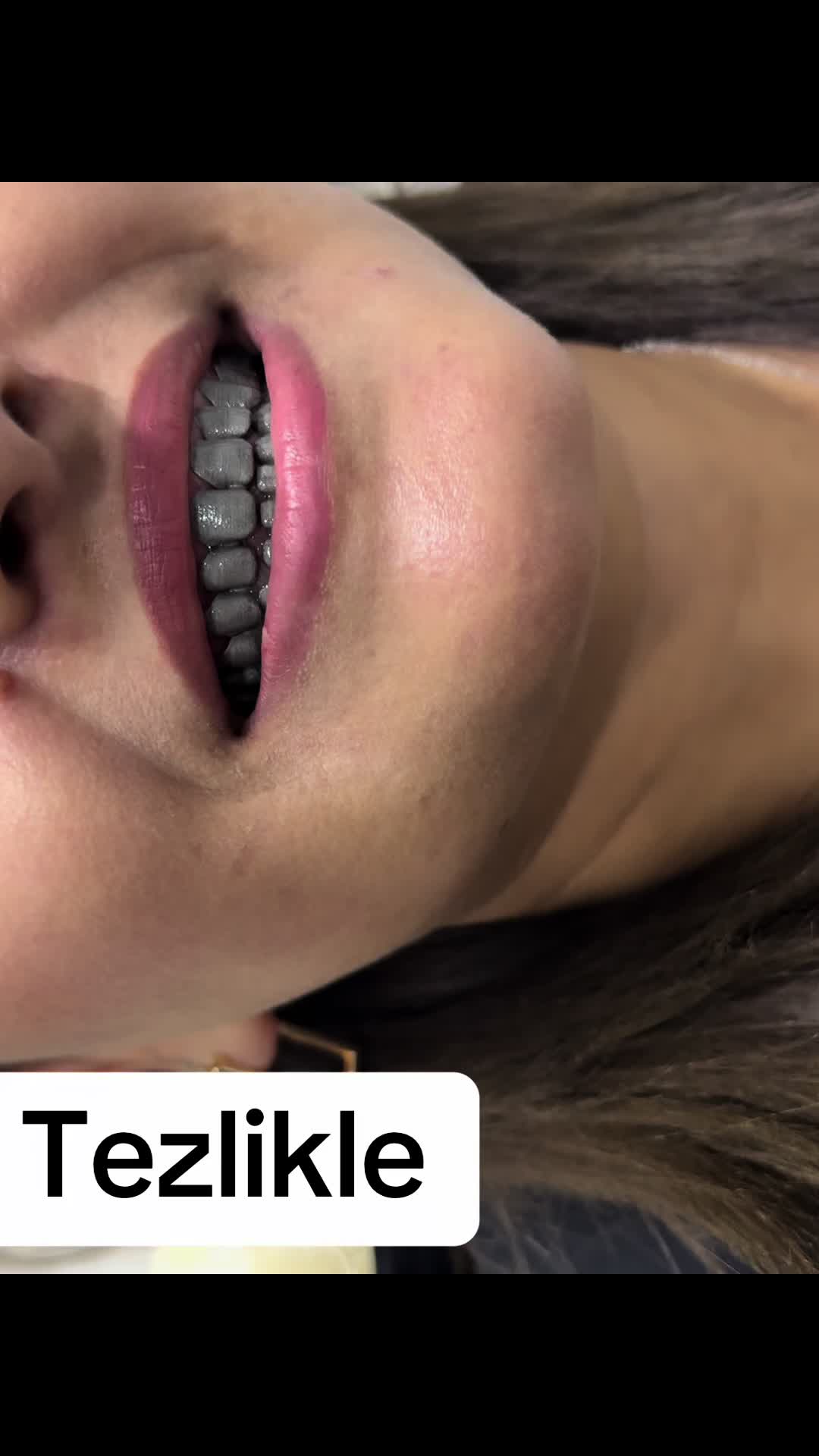 @Dentist_G&uuml;nel