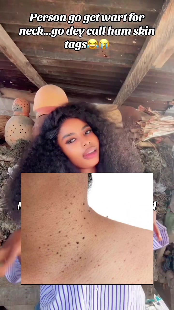 @GeNz_alagbo🪾🐍🍯