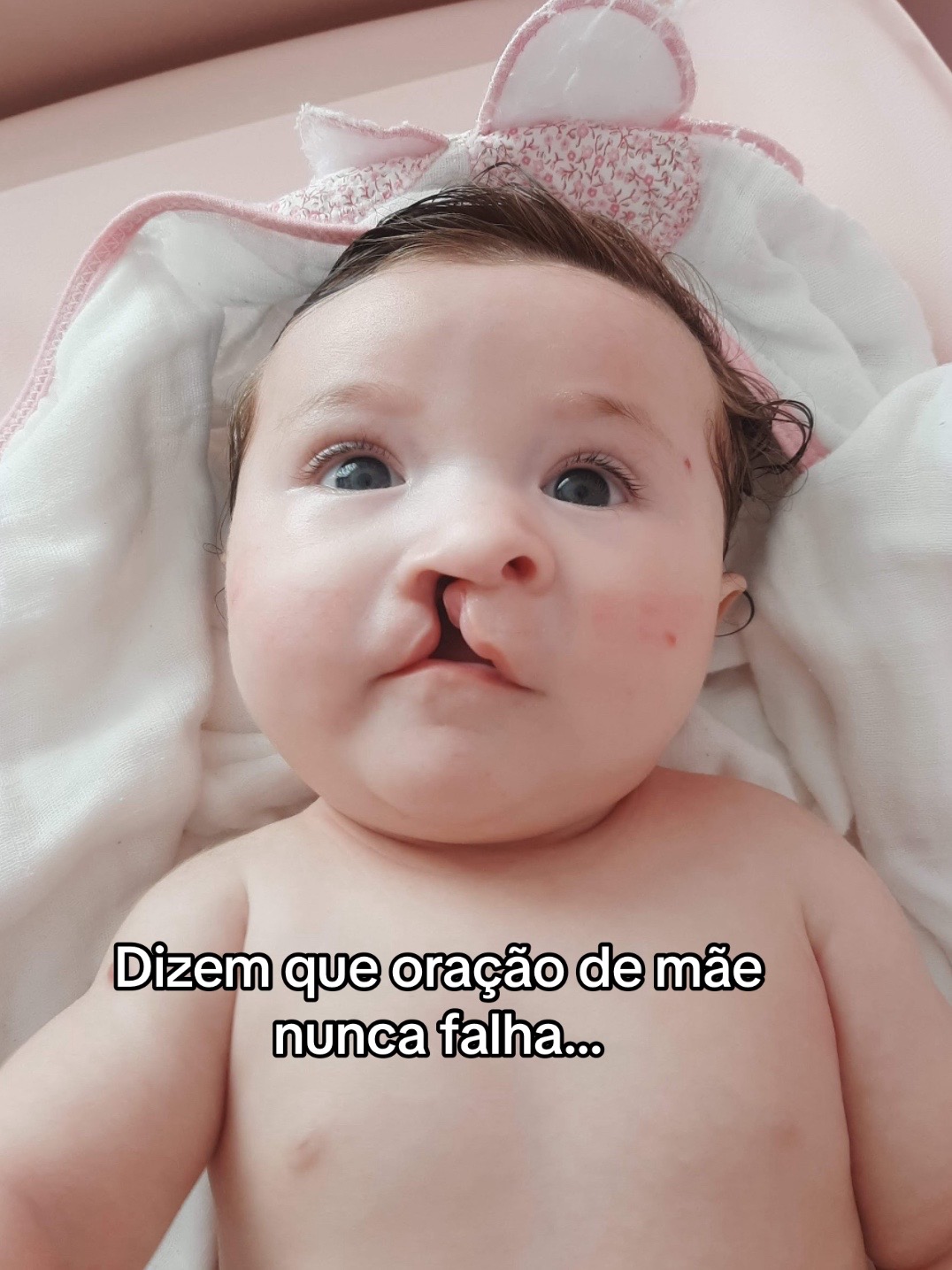 @_umafissuradinha