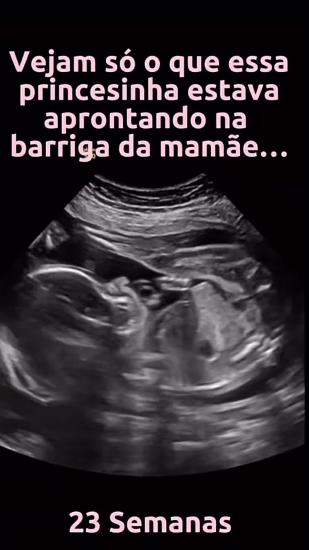 @Dicas de Maternidade🤰🏻👶🏻❤️