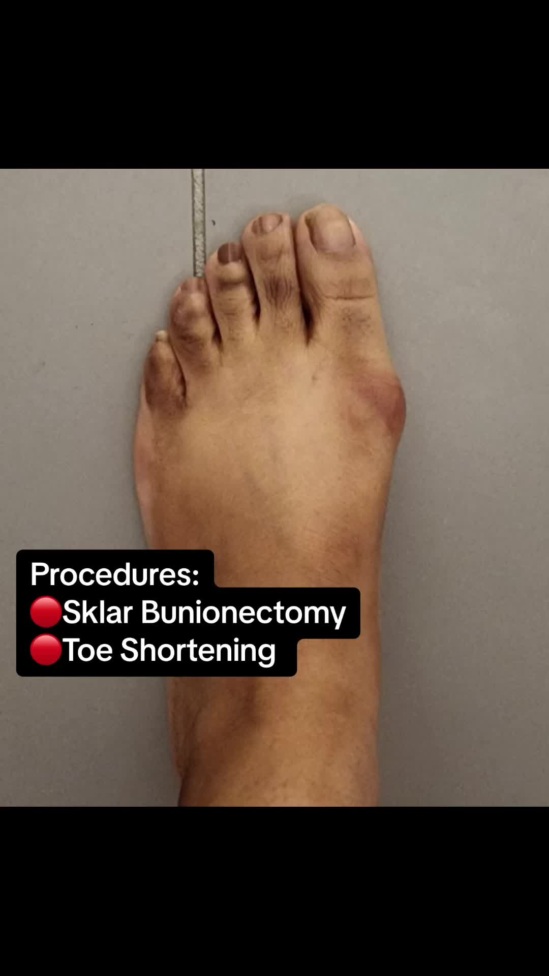 @Foot First Podiatry