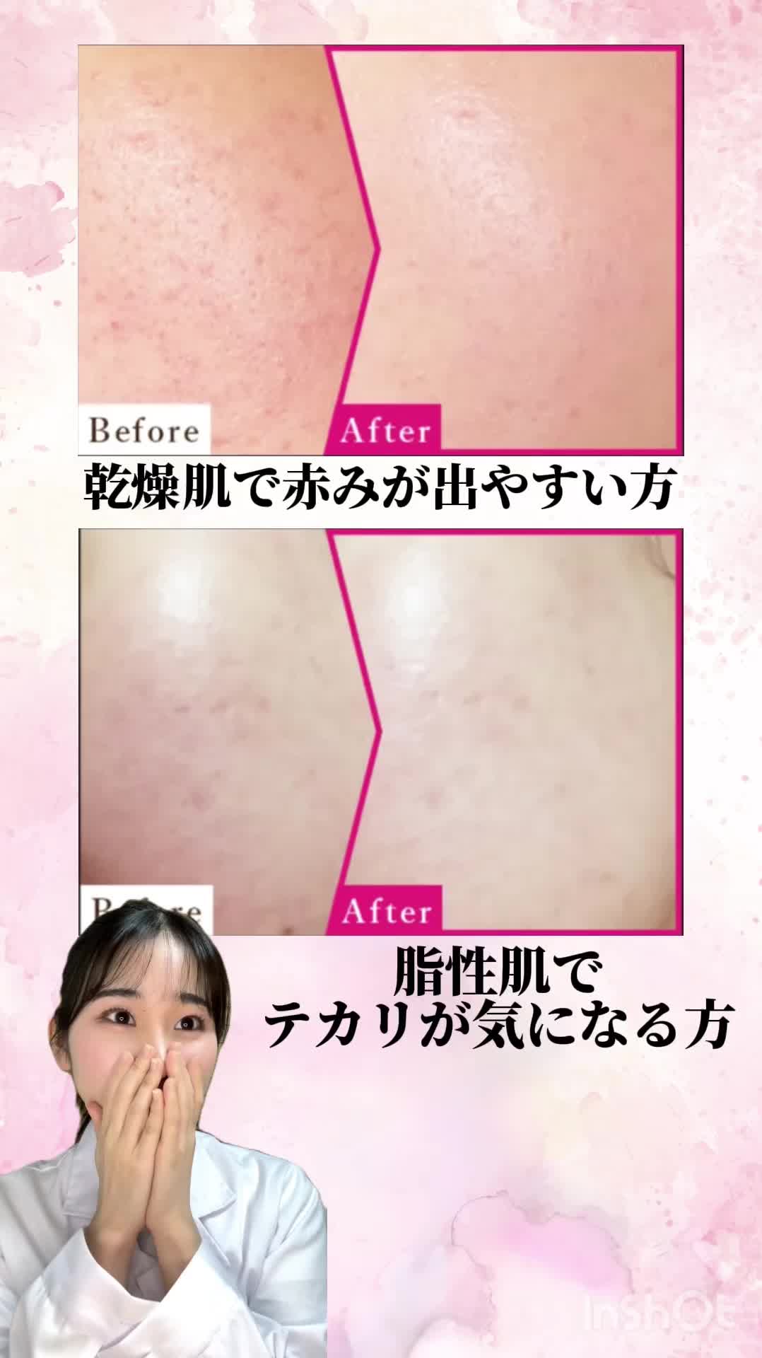 @kokolog / ココログ