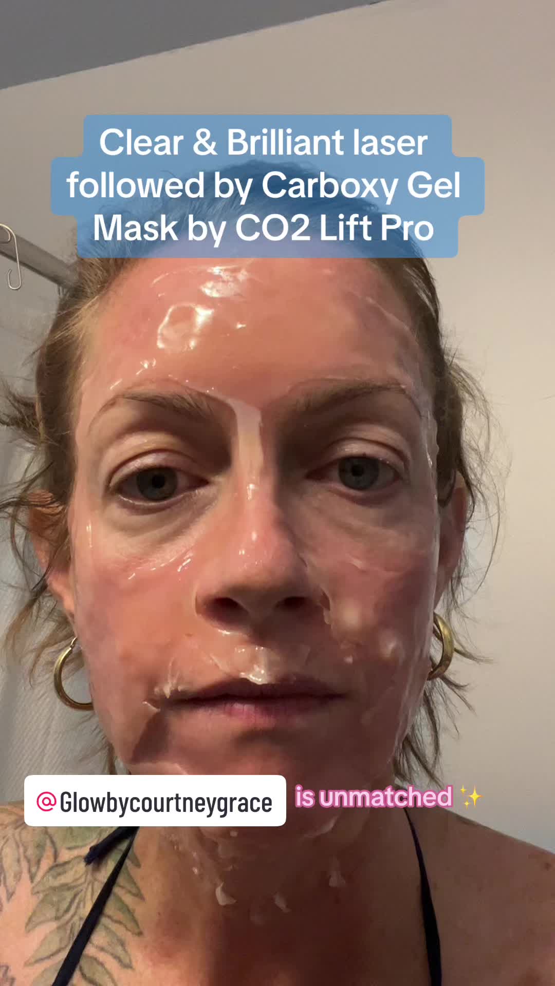 @Laura