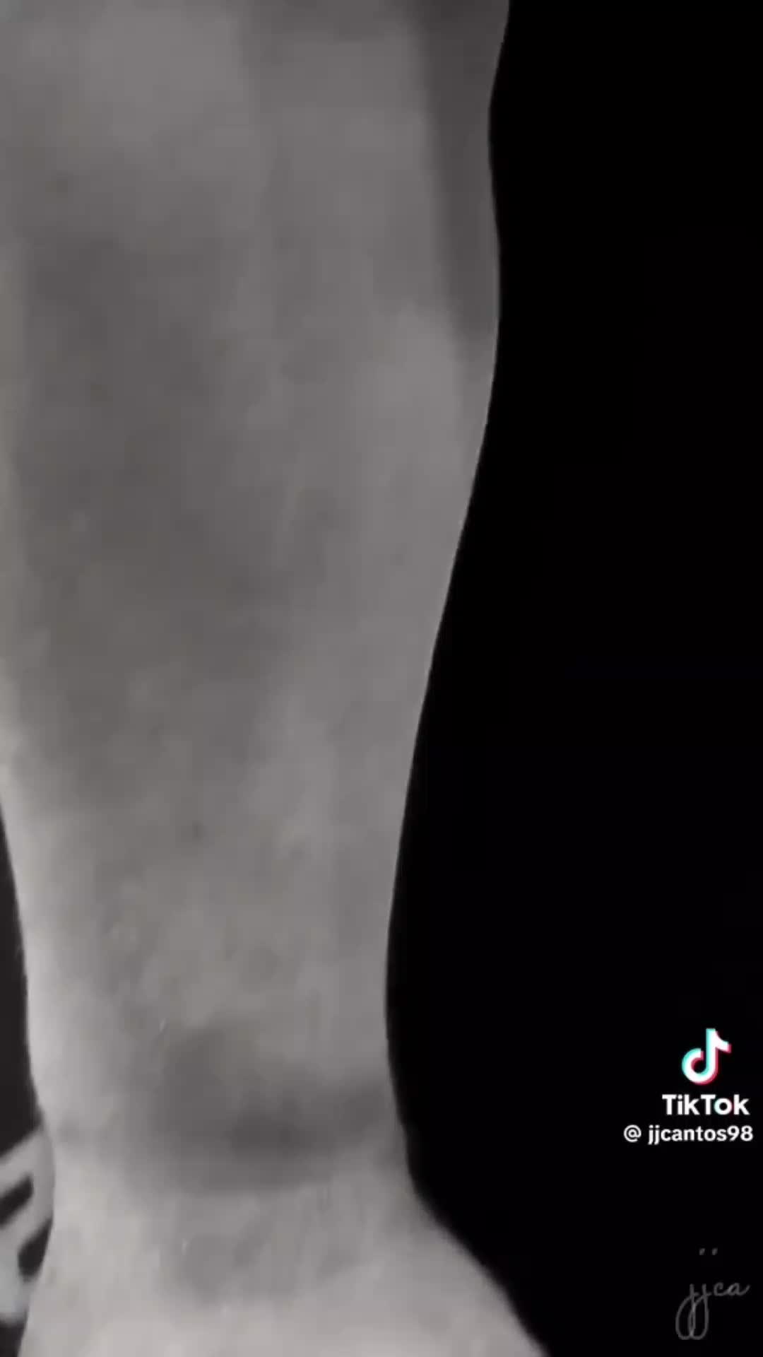 @F A N T A S T I O N 1