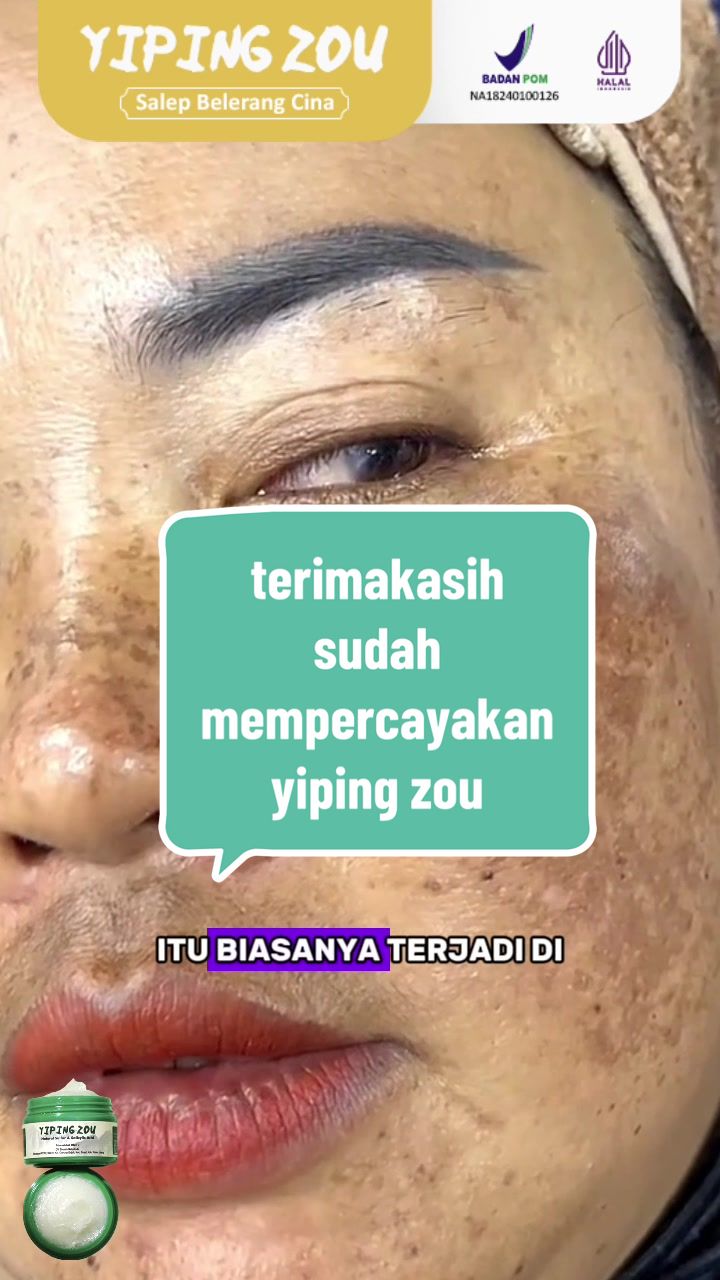 Yiping Zou (@yipingzou.official) - Urlebird