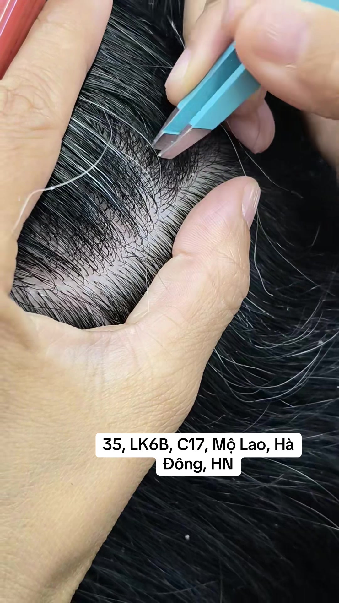 @Nhổ tóc bạc Hà Đông