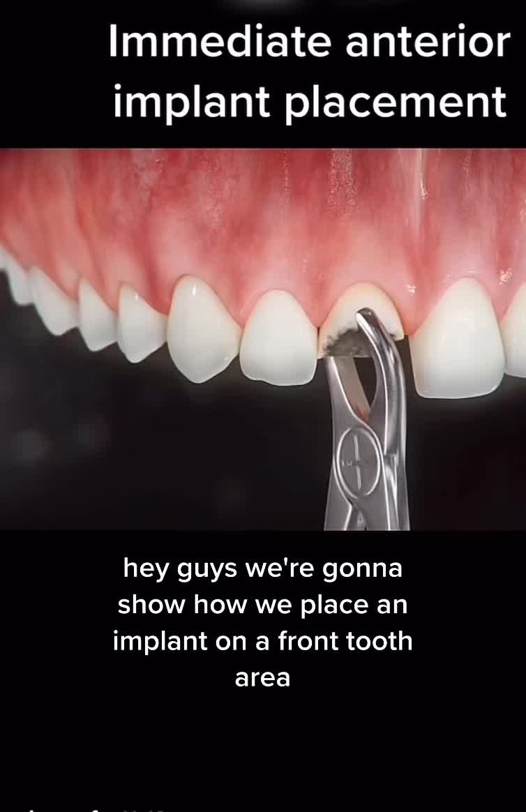 @Dentite