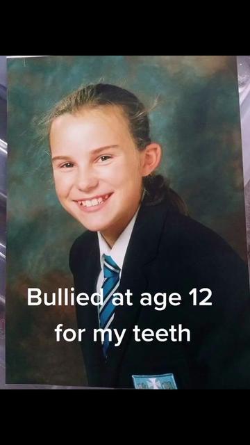 @Lizzy