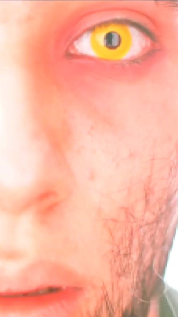 @M&OElig;NIA