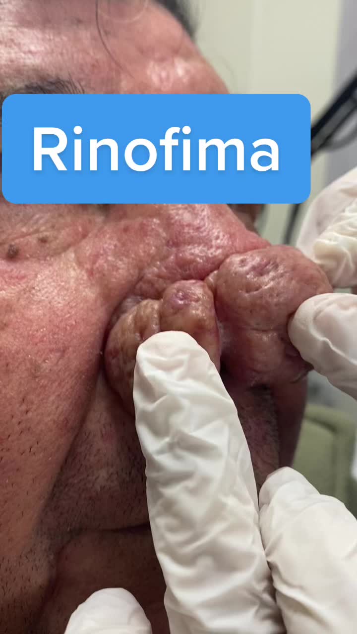 @dr.idrogodermatologo