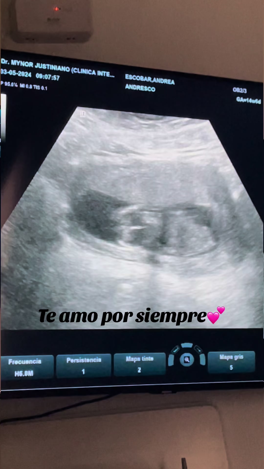 @Andrea Escobar