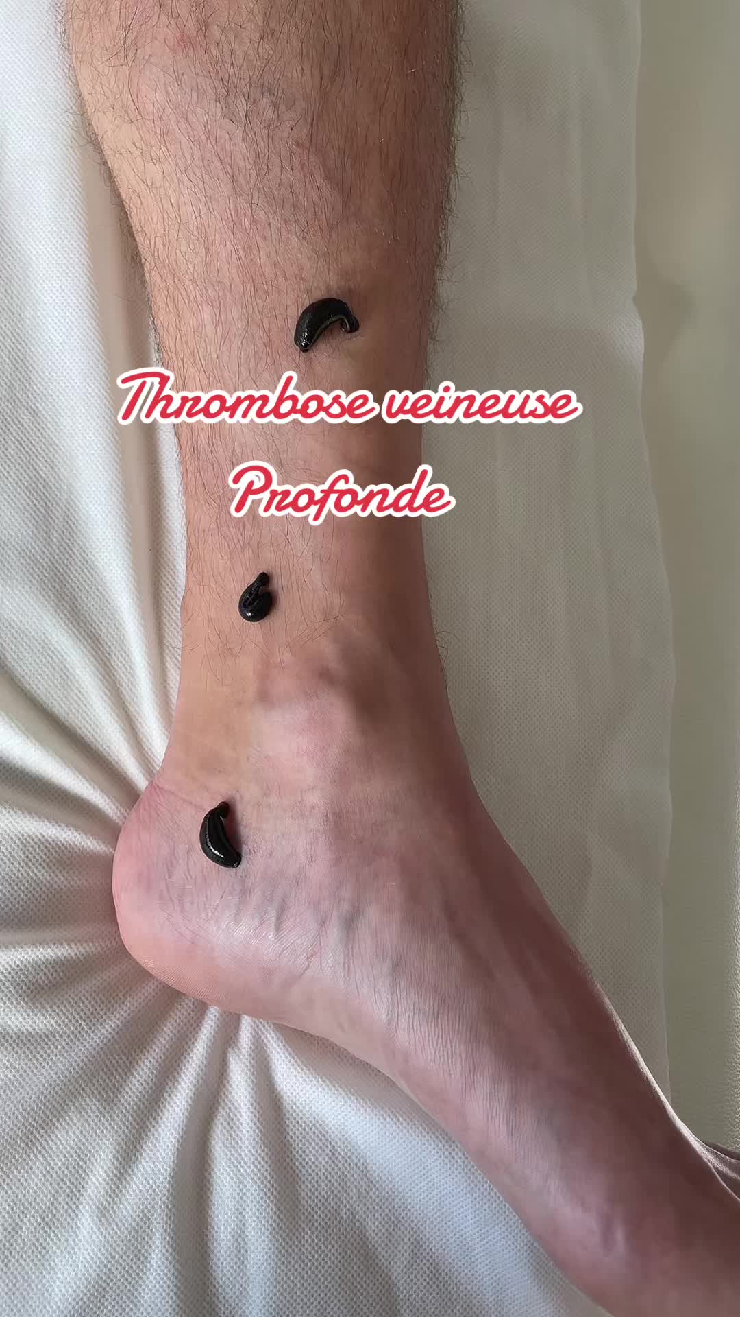 @Emyphysio🌺