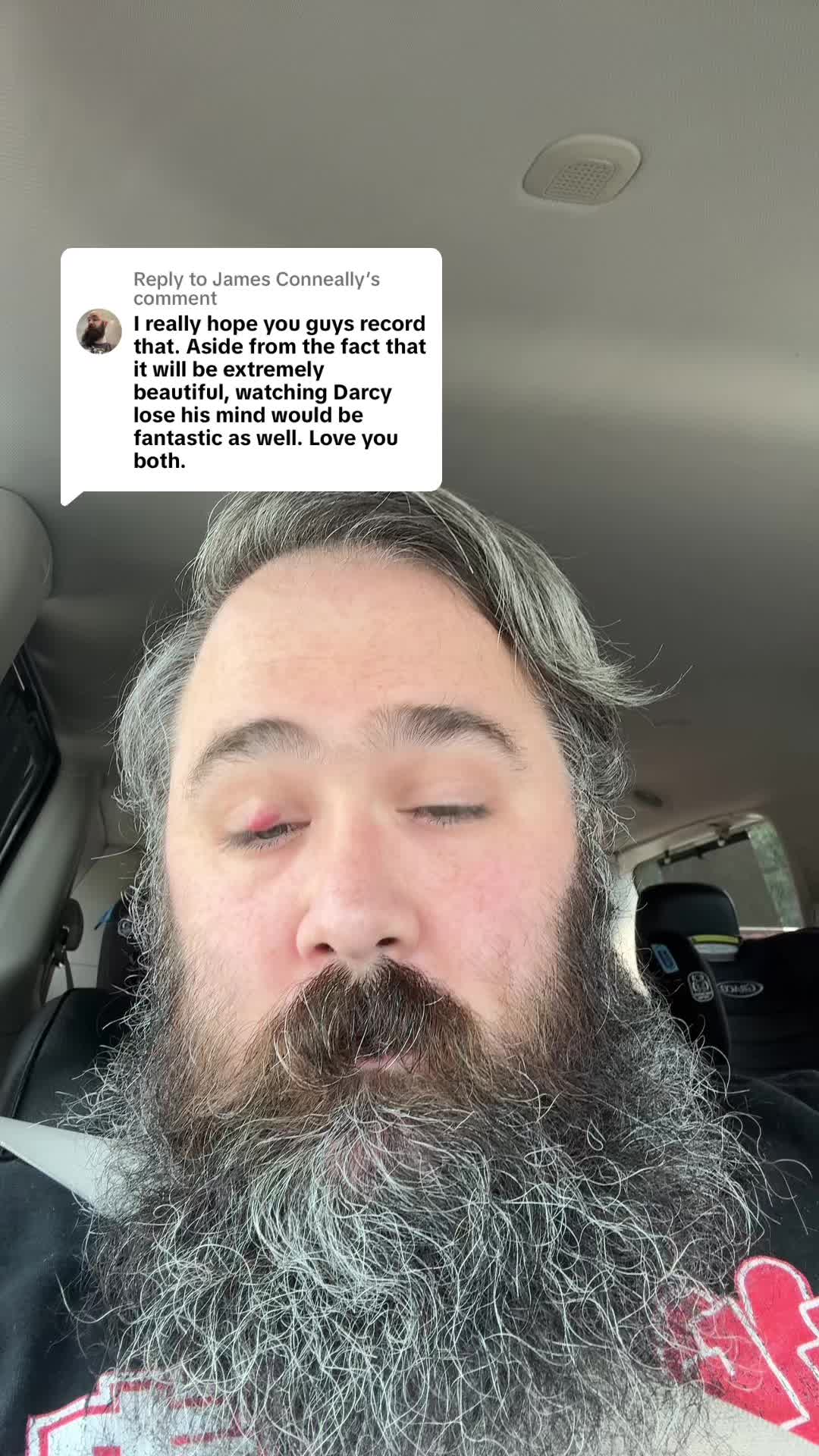 @James Conneally