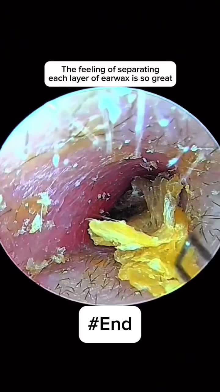 @Earwax.pro